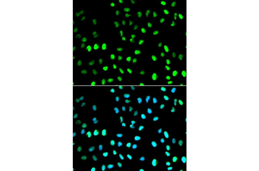 Anti-SUMO1 Antibody from Bioworld Technology (BS6755) - Antibodies.com