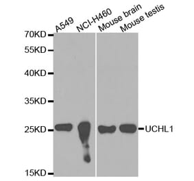 Anti-UCHL1 Antibody from Bioworld Technology (BS6756) - Antibodies.com