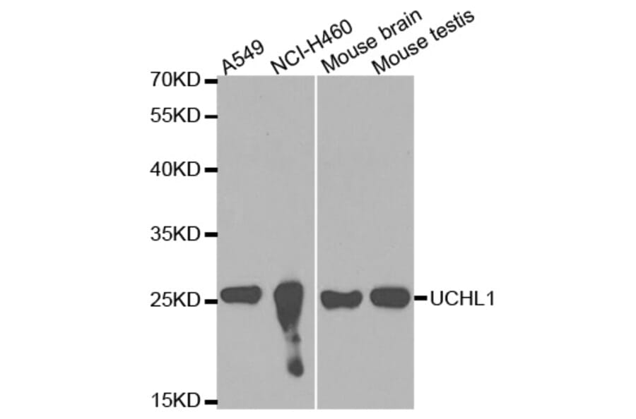 Anti-UCHL1 Antibody from Bioworld Technology (BS6756) - Antibodies.com