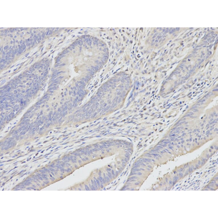 Anti-UCHL1 Antibody from Bioworld Technology (BS6756) - Antibodies.com