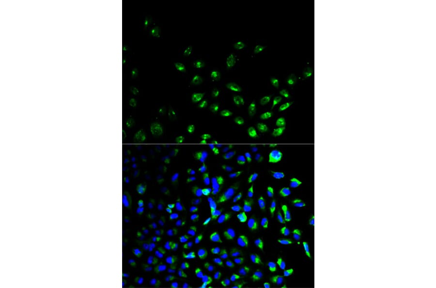 Anti-UCHL1 Antibody from Bioworld Technology (BS6756) - Antibodies.com