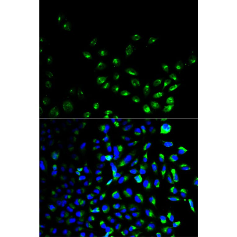 Anti-UCHL1 Antibody from Bioworld Technology (BS6756) - Antibodies.com