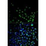 Anti-UCHL1 Antibody from Bioworld Technology (BS6756) - Antibodies.com