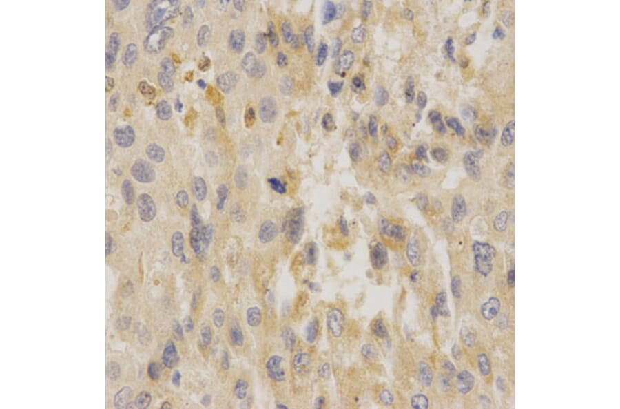 Anti-UCP3 Antibody from Bioworld Technology (BS6757) - Antibodies.com