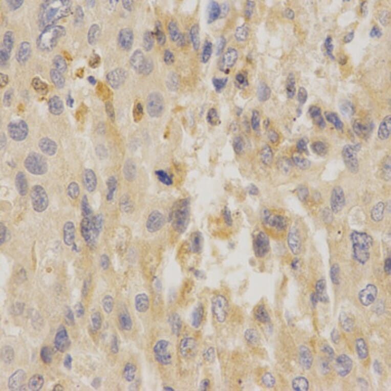 Anti-UCP3 Antibody from Bioworld Technology (BS6757) - Antibodies.com