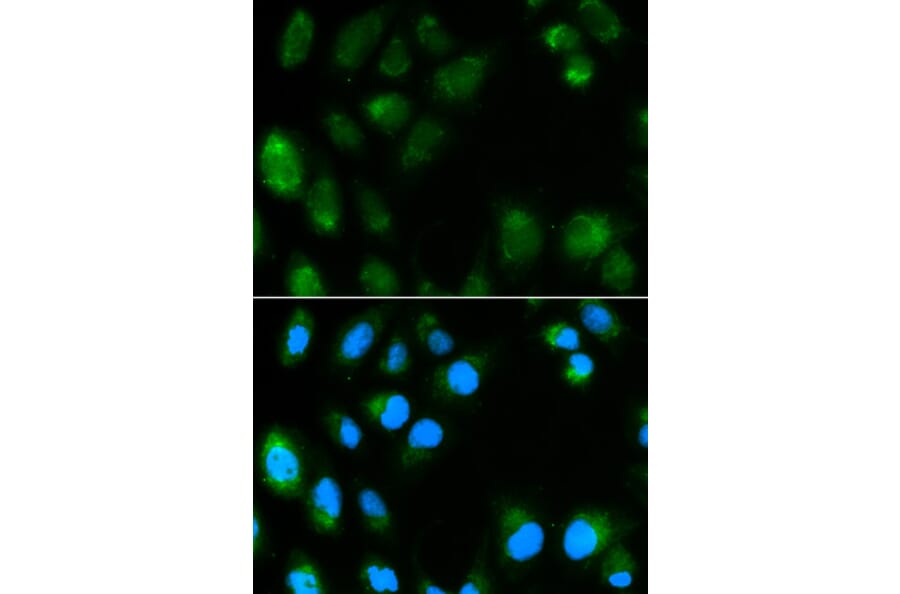 Anti-UCP3 Antibody from Bioworld Technology (BS6757) - Antibodies.com