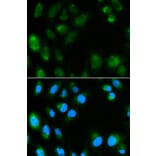 Anti-UCP3 Antibody from Bioworld Technology (BS6757) - Antibodies.com