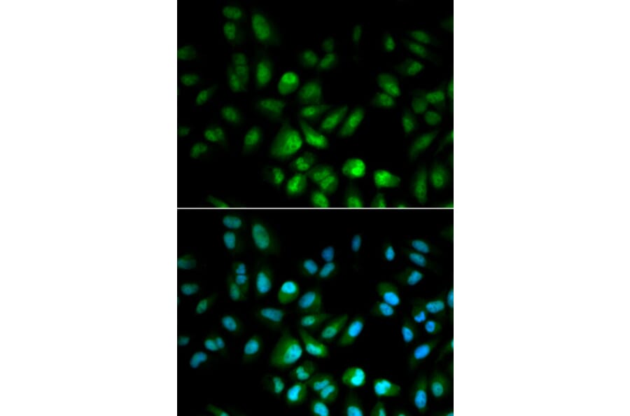 Anti-USF1 Antibody from Bioworld Technology (BS6759) - Antibodies.com