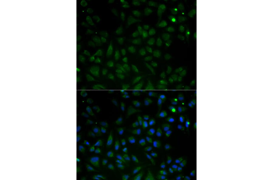 Anti-VDAC1 Antibody from Bioworld Technology (BS6760) - Antibodies.com