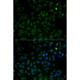 Anti-VDAC1 Antibody from Bioworld Technology (BS6760) - Antibodies.com