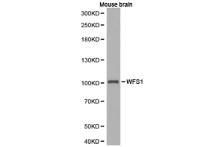 Anti-WFS1 Antibody from Bioworld Technology (BS6764) - Antibodies.com
