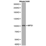 Anti-WFS1 Antibody from Bioworld Technology (BS6764) - Antibodies.com