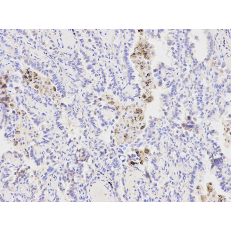Anti-XPA Antibody from Bioworld Technology (BS6766) - Antibodies.com