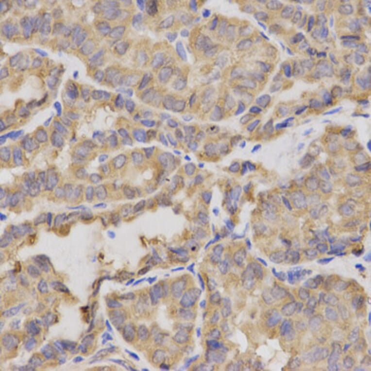 Anti-XRCC2 Antibody from Bioworld Technology (BS6767) - Antibodies.com