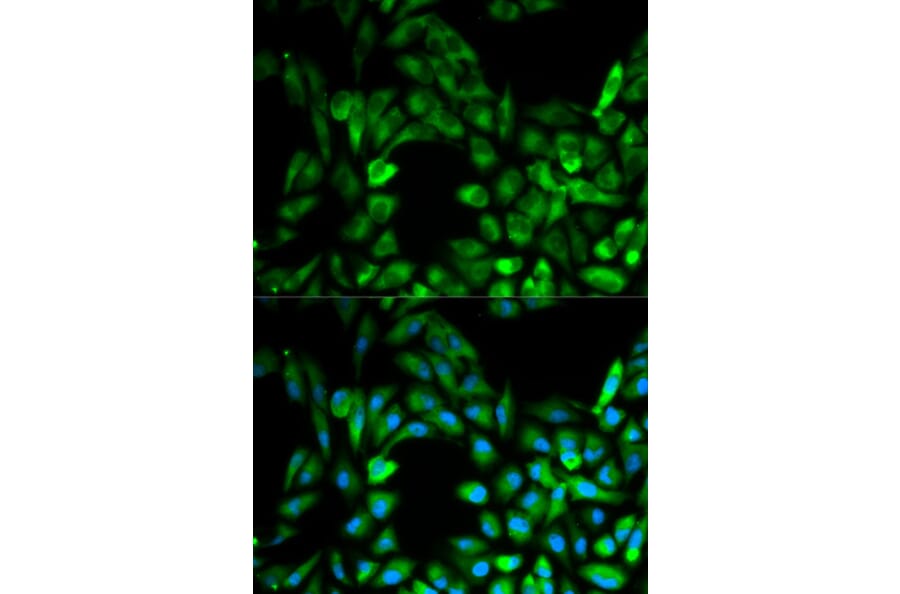 Anti-IKKγ Antibody from Bioworld Technology (BS6772) - Antibodies.com