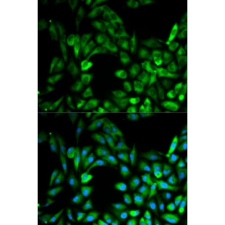 Anti-IKKγ Antibody from Bioworld Technology (BS6772) - Antibodies.com