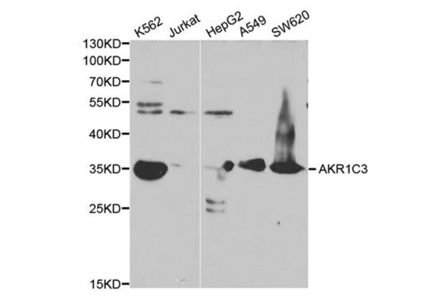 Anti-AKR1C3 Antibody from Bioworld Technology (BS6774) - Antibodies.com