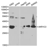 Anti-AKR1C3 Antibody from Bioworld Technology (BS6774) - Antibodies.com