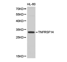 Anti-TNFRSF14 Antibody from Bioworld Technology (BS6775) - Antibodies.com