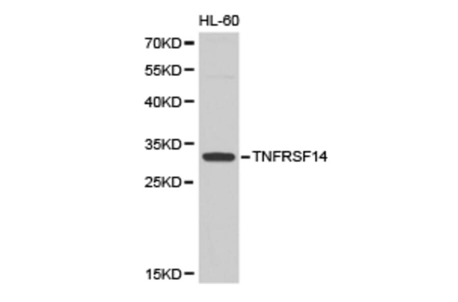 Anti-TNFRSF14 Antibody from Bioworld Technology (BS6775) - Antibodies.com