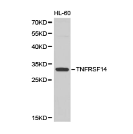 Anti-TNFRSF14 Antibody from Bioworld Technology (BS6775) - Antibodies.com
