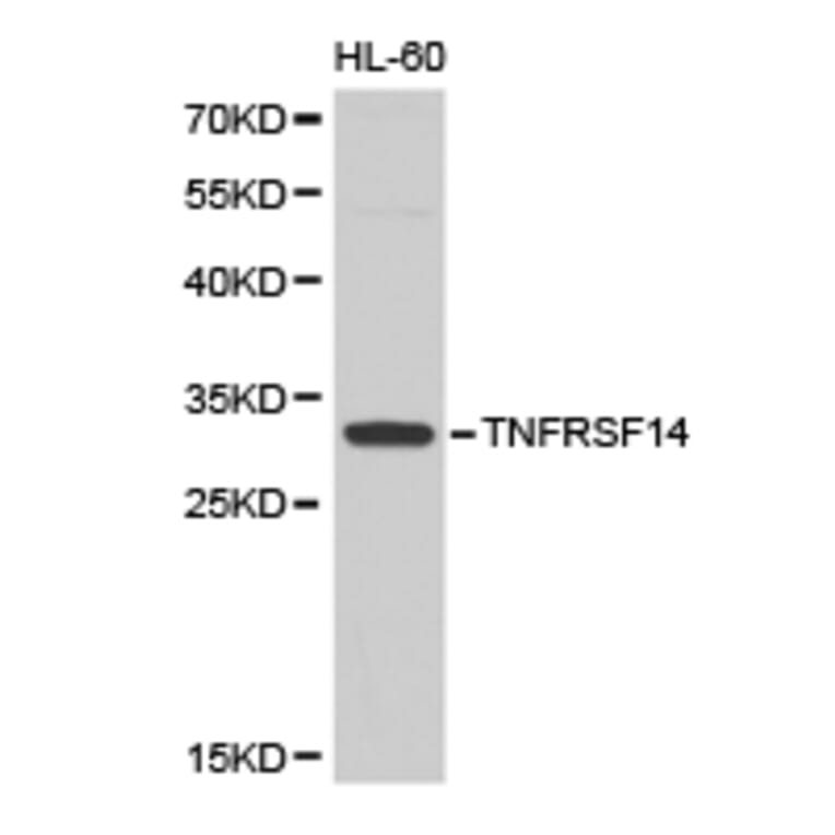 Anti-TNFRSF14 Antibody from Bioworld Technology (BS6775) - Antibodies.com