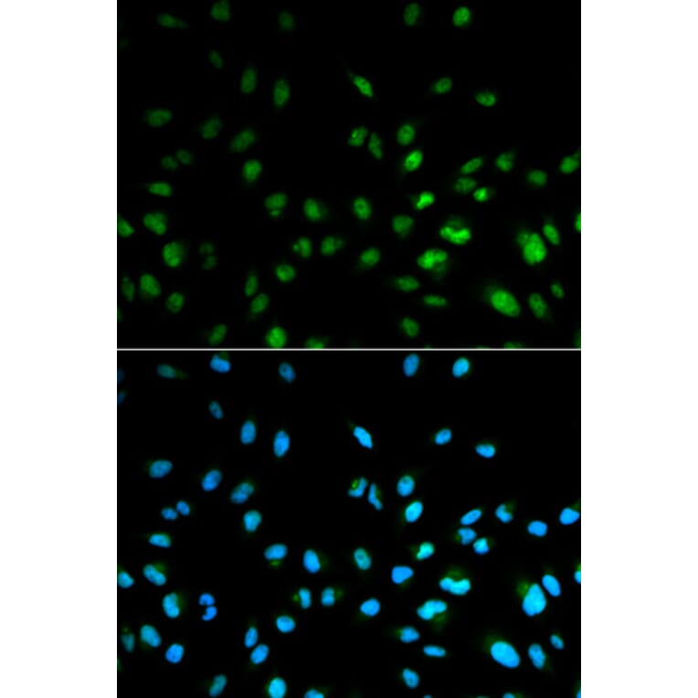 Anti-HDAC3 Antibody from Bioworld Technology (BS6776) - Antibodies.com