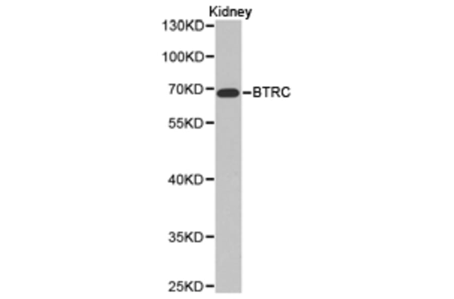 Anti-BTRC Antibody from Bioworld Technology (BS6777) - Antibodies.com