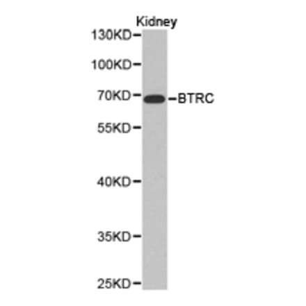 Anti-BTRC Antibody from Bioworld Technology (BS6777) - Antibodies.com