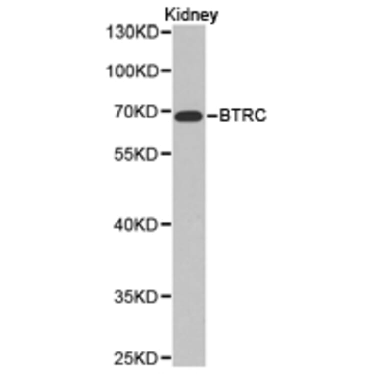 Anti-BTRC Antibody from Bioworld Technology (BS6777) - Antibodies.com
