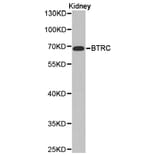 Anti-BTRC Antibody from Bioworld Technology (BS6777) - Antibodies.com