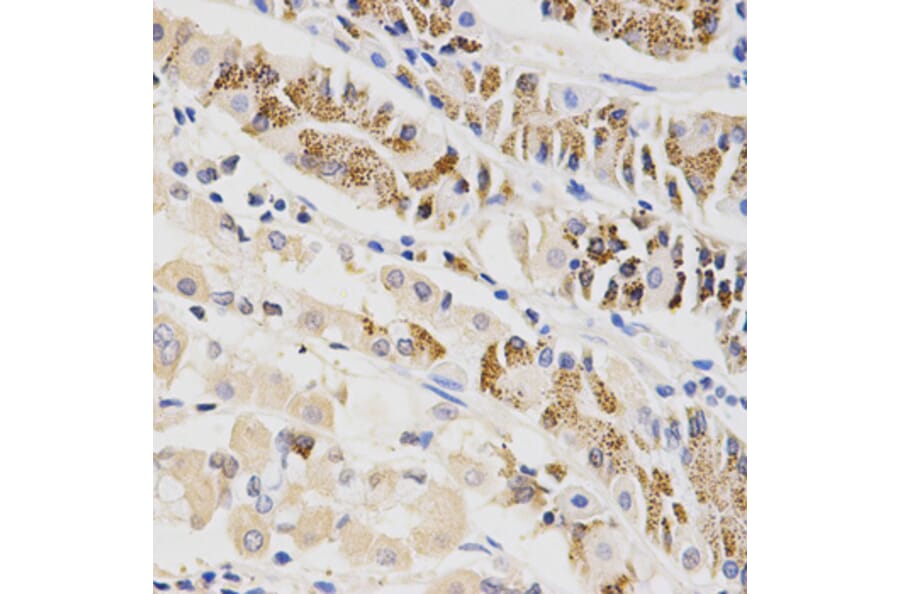 Anti-BTRC Antibody from Bioworld Technology (BS6777) - Antibodies.com