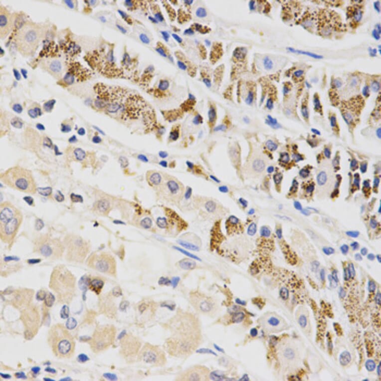 Anti-BTRC Antibody from Bioworld Technology (BS6777) - Antibodies.com