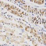 Anti-BTRC Antibody from Bioworld Technology (BS6777) - Antibodies.com