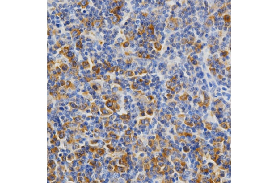 Anti-KEAP1 Antibody from Bioworld Technology (BS6783) - Antibodies.com