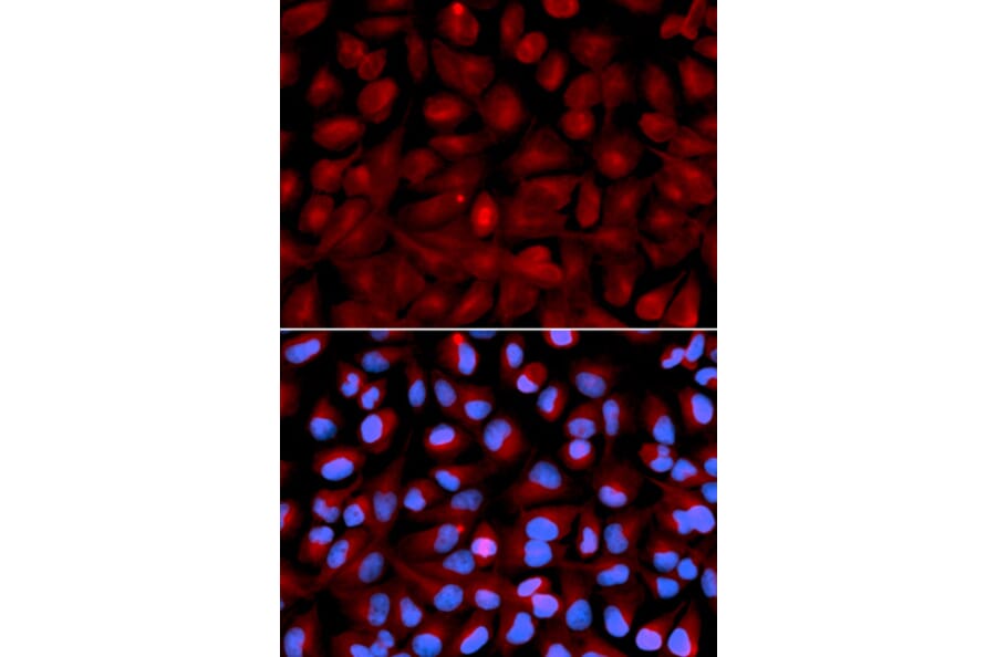 Anti-HDAC6 Antibody from Bioworld Technology (BS6784) - Antibodies.com