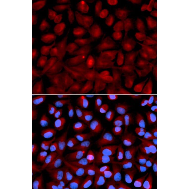 Anti-HDAC6 Antibody from Bioworld Technology (BS6784) - Antibodies.com