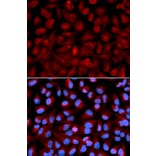 Anti-HDAC6 Antibody from Bioworld Technology (BS6784) - Antibodies.com