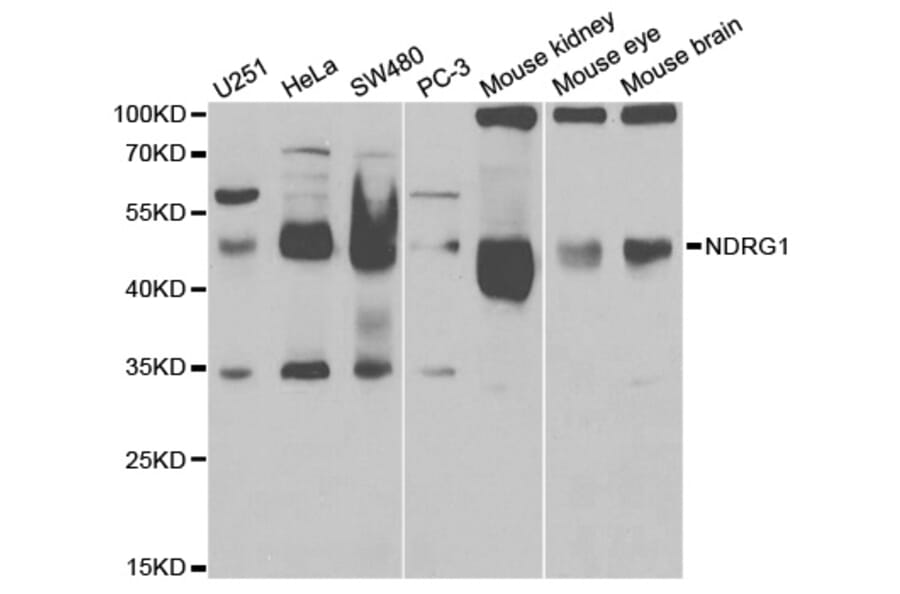 Anti-NDRG1 Antibody from Bioworld Technology (BS6786) - Antibodies.com