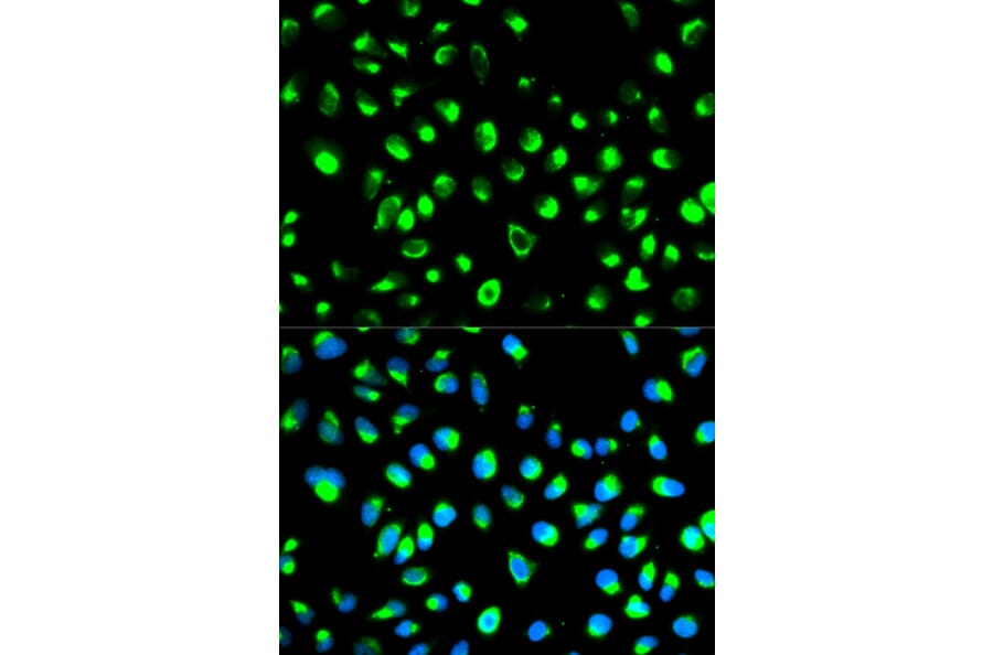 Anti-NDRG1 Antibody from Bioworld Technology (BS6786) - Antibodies.com
