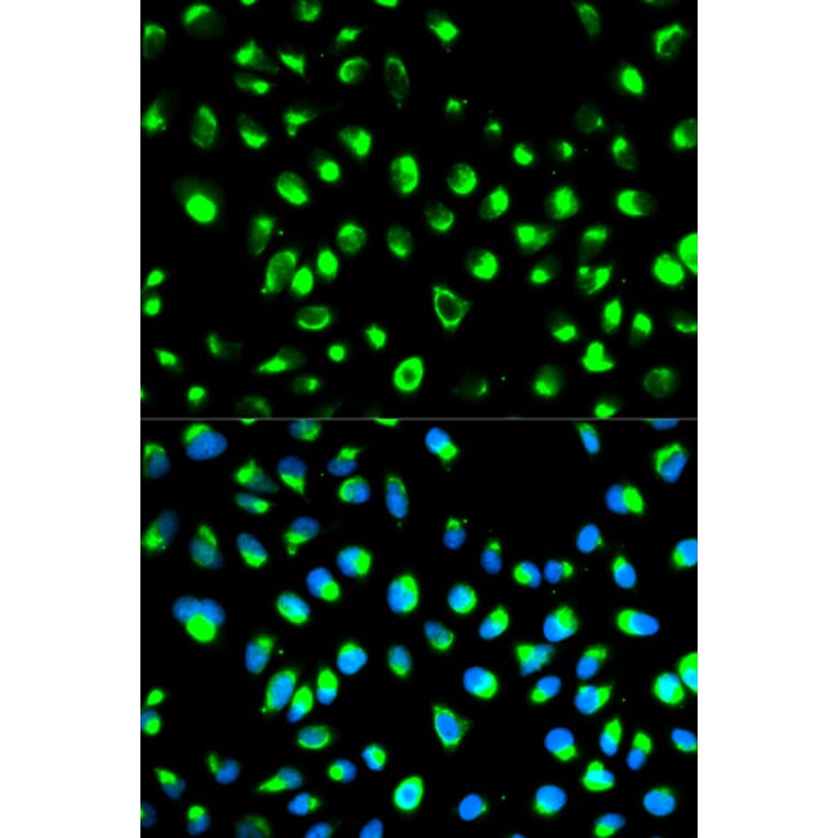 Anti-NDRG1 Antibody from Bioworld Technology (BS6786) - Antibodies.com