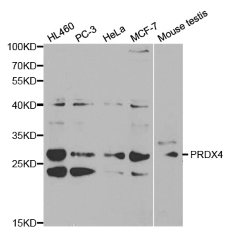 Anti-PRDX4 Antibody from Bioworld Technology (BS6787) - Antibodies.com