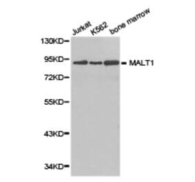 Anti-MALT1 Antibody from Bioworld Technology (BS6789) - Antibodies.com