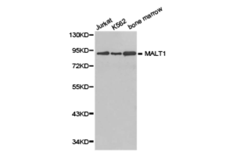 Anti-MALT1 Antibody from Bioworld Technology (BS6789) - Antibodies.com