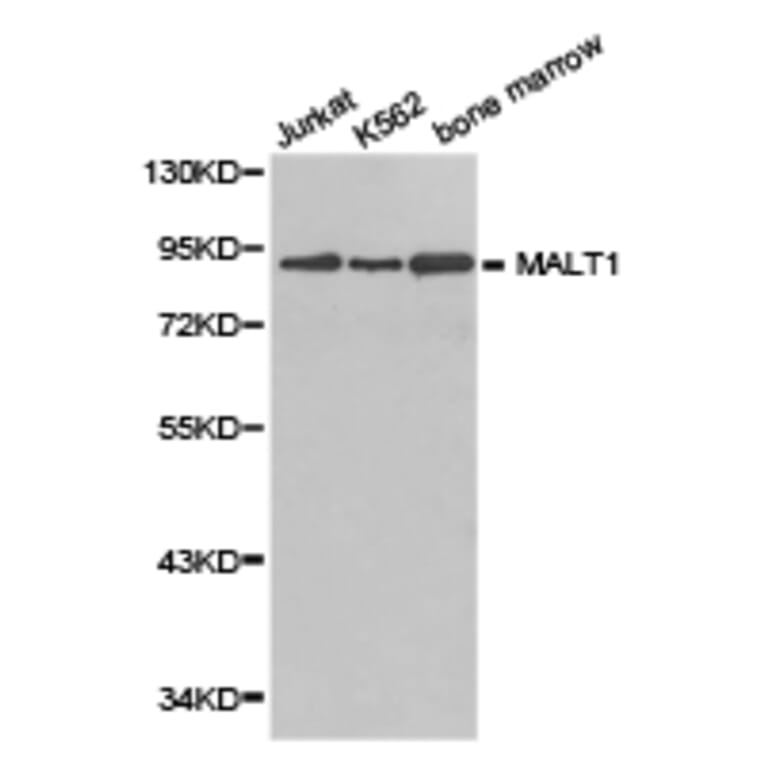 Anti-MALT1 Antibody from Bioworld Technology (BS6789) - Antibodies.com