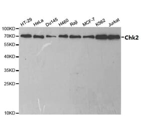 Anti-Chk2 Antibody from Bioworld Technology (BS6791) - Antibodies.com