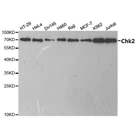 Anti-Chk2 Antibody from Bioworld Technology (BS6791) - Antibodies.com