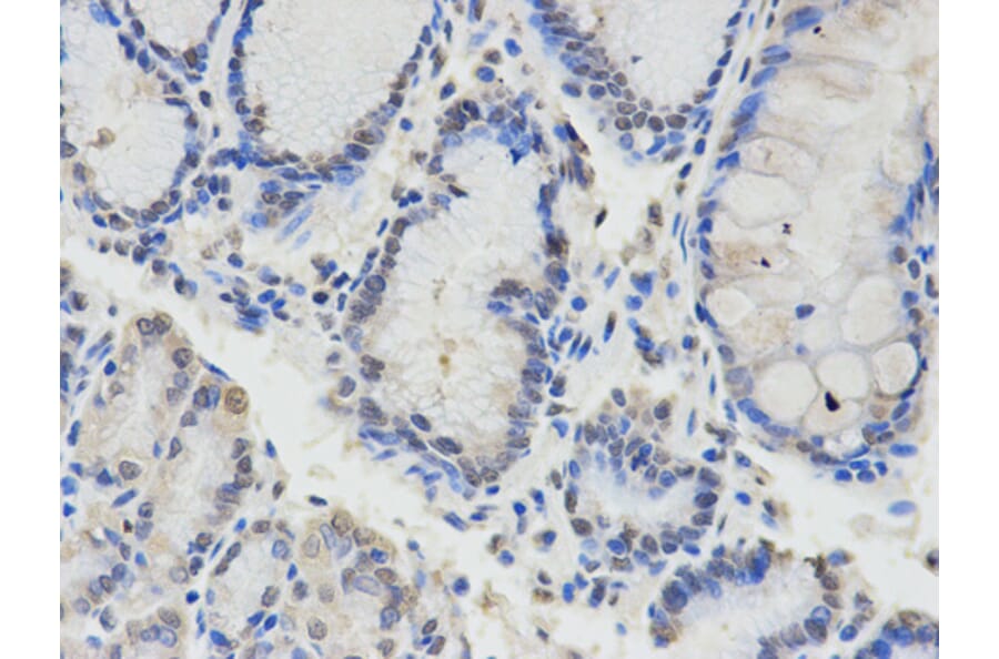 Anti-Chk2 Antibody from Bioworld Technology (BS6791) - Antibodies.com