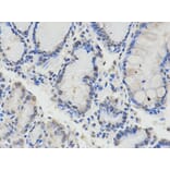 Anti-Chk2 Antibody from Bioworld Technology (BS6791) - Antibodies.com