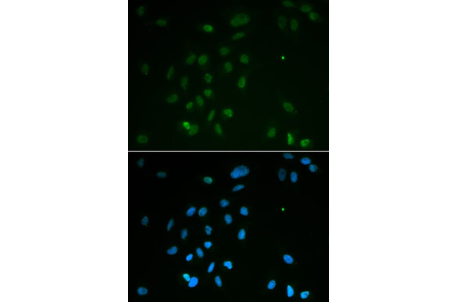 Anti-Chk2 Antibody from Bioworld Technology (BS6791) - Antibodies.com